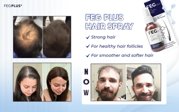 FEG HAIR GROWTH SPRYAY