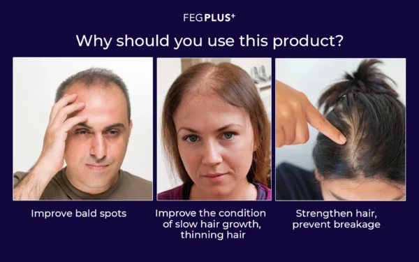 FEG HAIR GROWTH SPRAY IN PAKISTAN